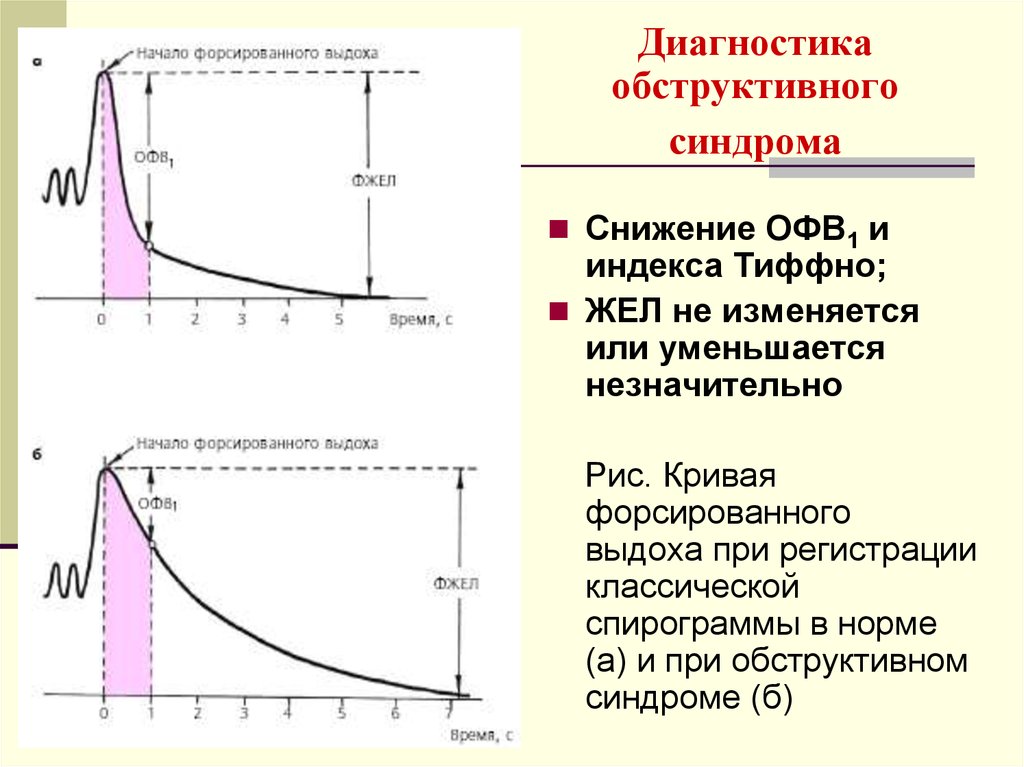 Что такое форсированный: ФОРСИРОВАННЫЙ | это... Что такое ФОРСИРОВАННЫЙ?