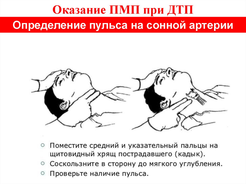 Медицинская помощь при дтп. Оказание первой медицинской помощи при ДТП. Как определить пульс на сонной артерии. Последовательность оказания помощи при ДТП.. Оказание первой медицинской помощи при ДТП кратко.