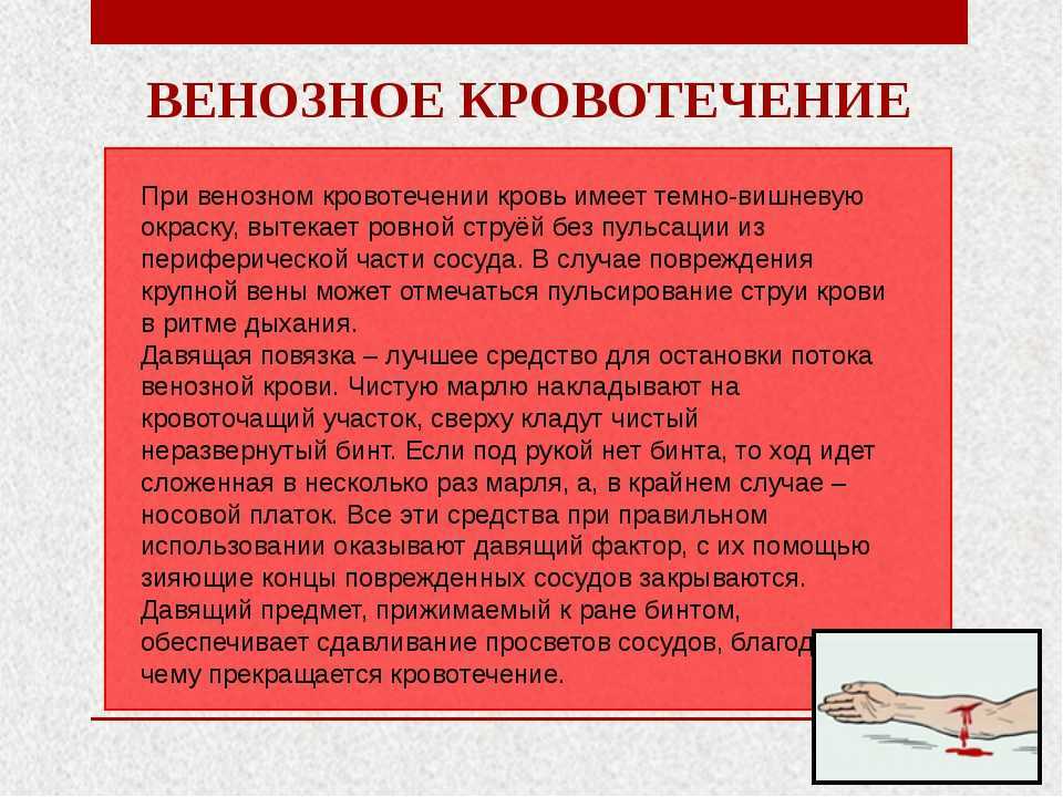 Артериальное стекло: Атермальное стекло - это какое? Преимущества и недостатки