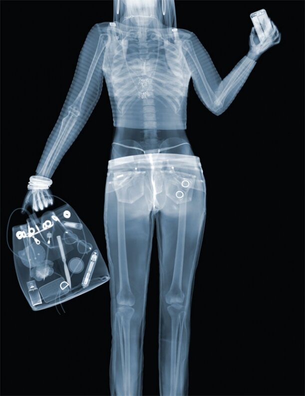Как хранить рентгеновские снимки: Как хранить рентгеновские пленки?