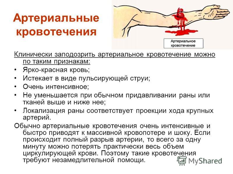 Артериальное стекло: Атермальное стекло - это какое? Преимущества и недостатки