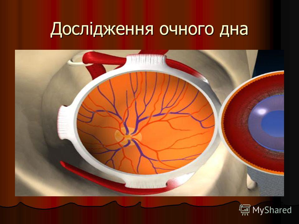 Артериальное стекло: Атермальное стекло - это какое? Преимущества и недостатки