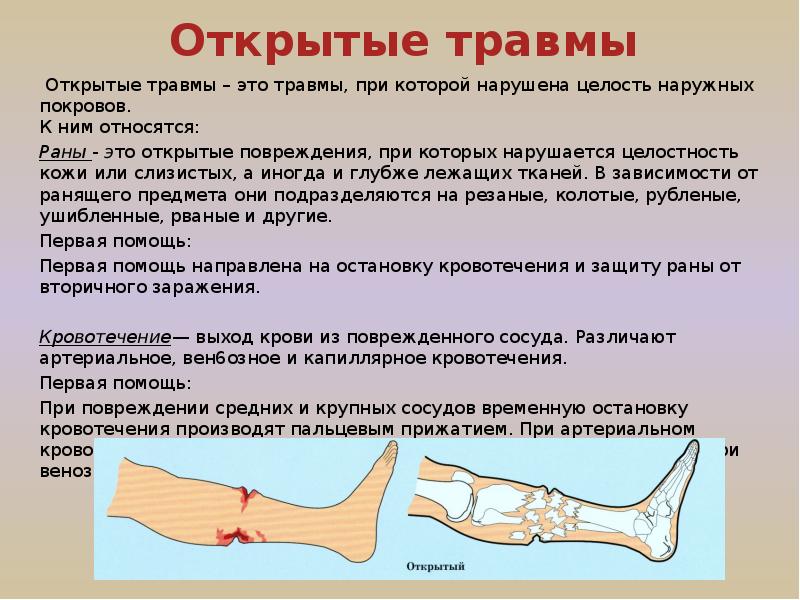 Артериальное стекло: Атермальное стекло - это какое? Преимущества и недостатки