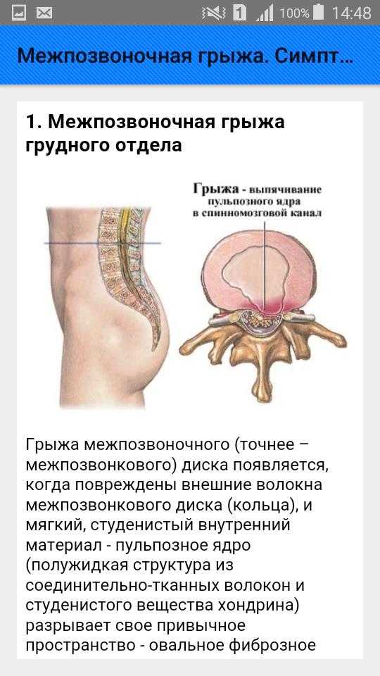 Радиальная грыжа колеса последствия: причины и способы устранения – Прокачай АВТО