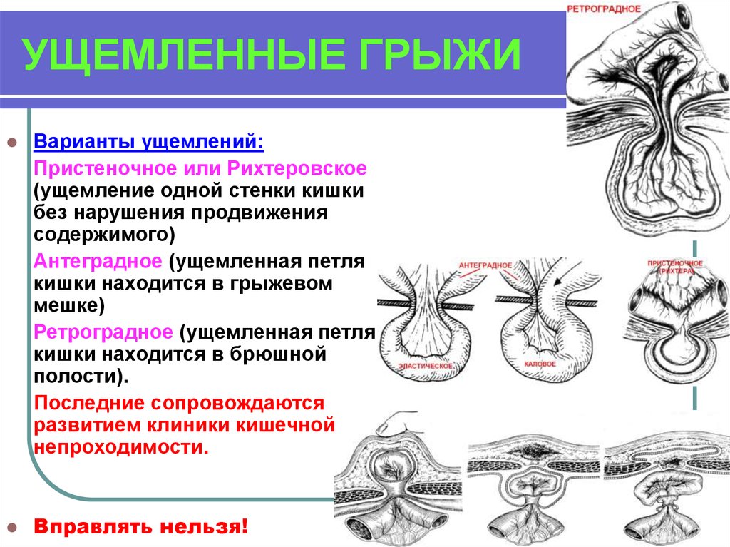 Радиальная грыжа колеса последствия: причины и способы устранения – Прокачай АВТО