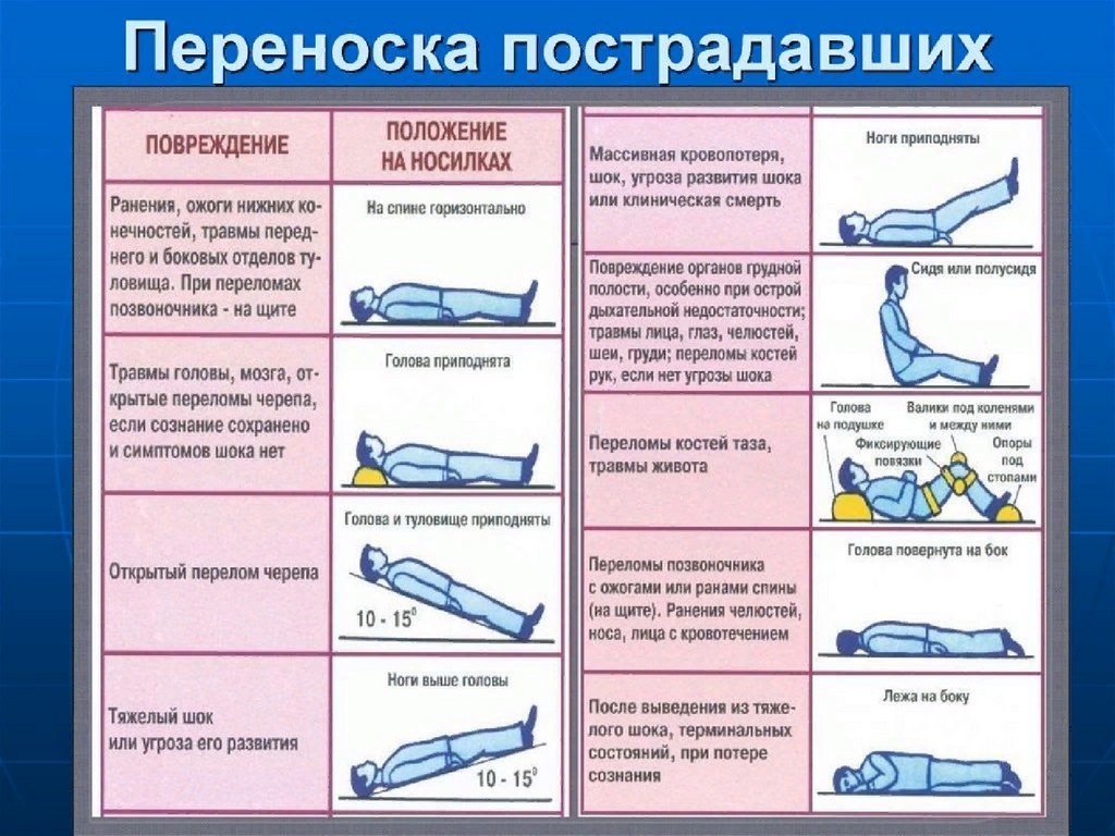 Травмы собак виды после автоаварии: Если собаку сбила машина. Интервью с хирургом