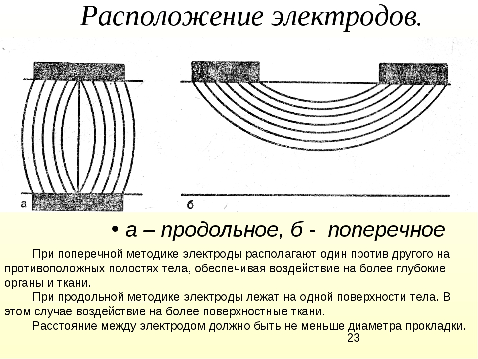 Продольное расположение: Поперечное и продольное расположение двигателя — преимущества и недостатки