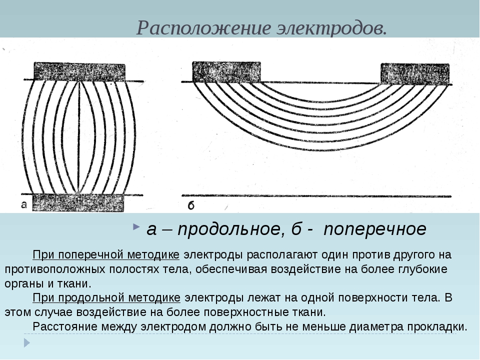 Продольное расположение: Поперечное и продольное расположение двигателя — преимущества и недостатки