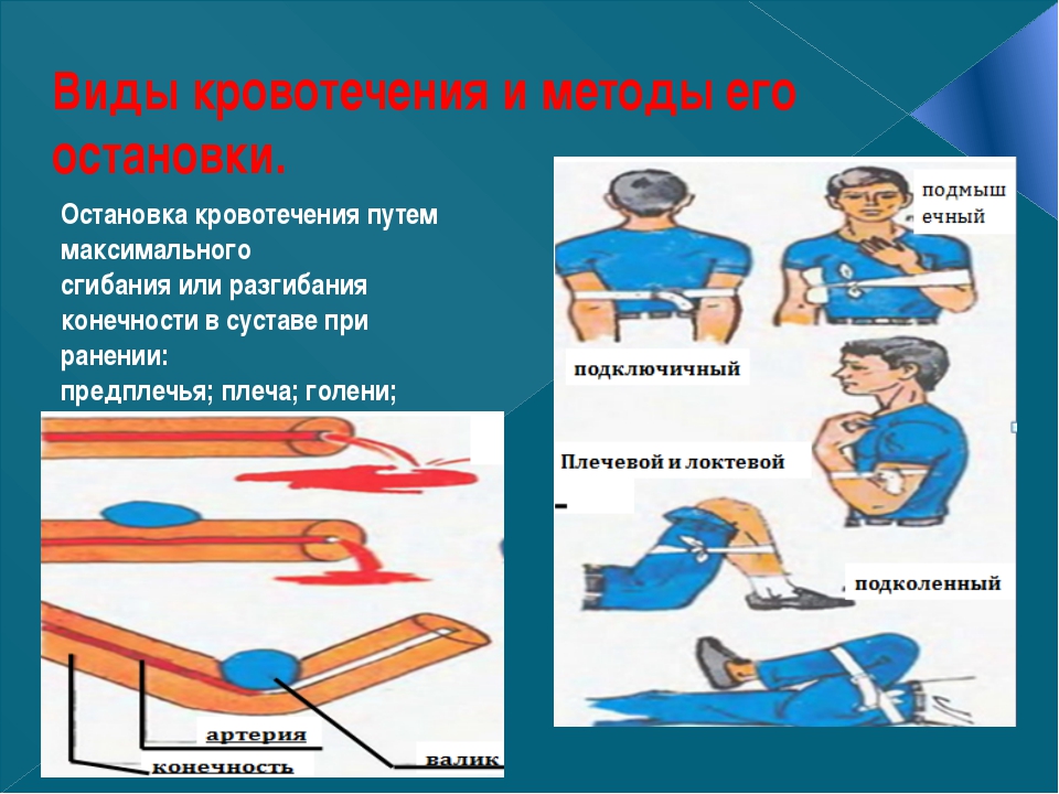 Презентация на тему первая помощь при ранениях