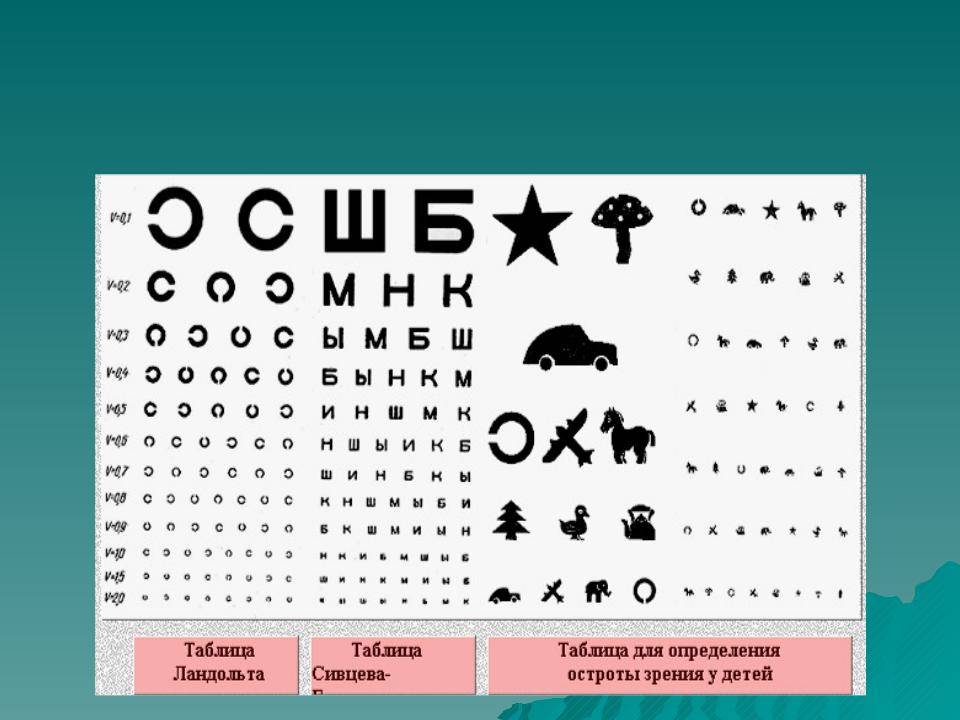 Как пройти офтальмолога с плохим зрением: Пройти окулиста на мед.справку с плохим зрением, но без очков!