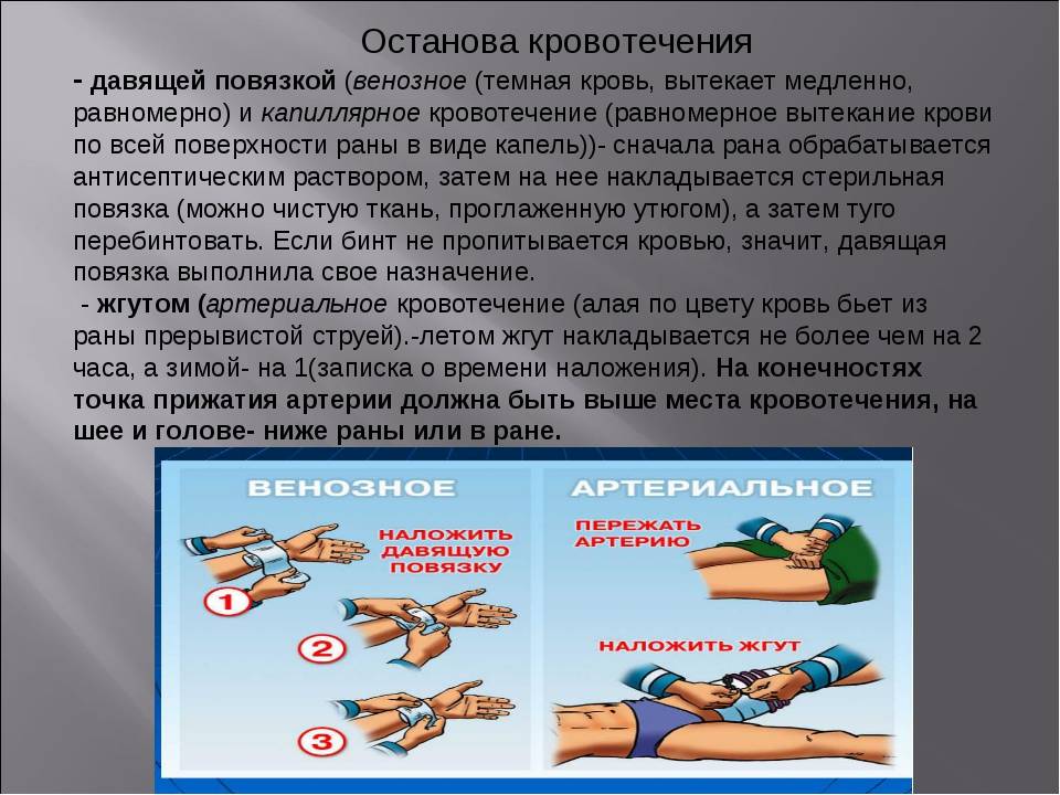 Травмы собак виды после автоаварии: Если собаку сбила машина. Интервью с хирургом