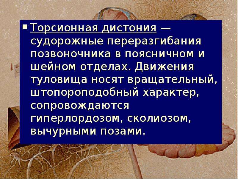 Торсионная: Торсионная балка плюсы и минусы. Торсионная балка