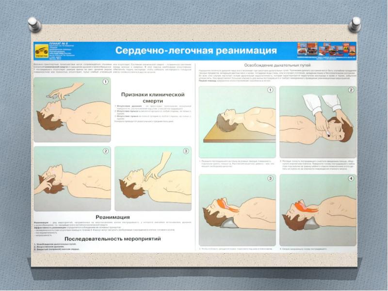 Первая доврачебная помощь при дтп: Первая помощь при ДТП