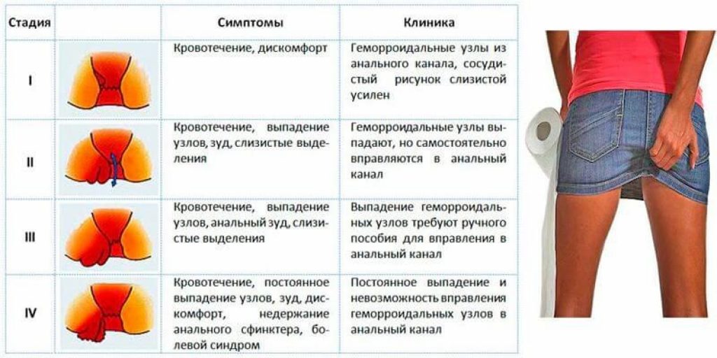 Трыдын что это: Что такое Трейд-ин при покупке автомобиля: что значит, условия Trade-In