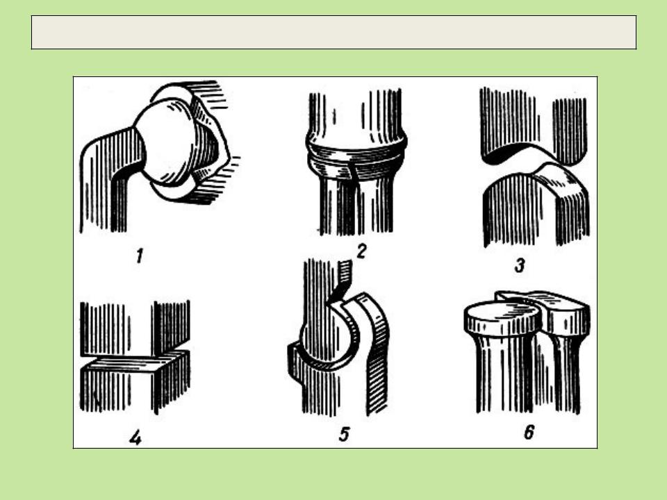 Формы суставов костей. Соединение костей шаровидный эллипсовидный. Формы суставов. Формы суставных поверхностей. Различные формы суставов схема.