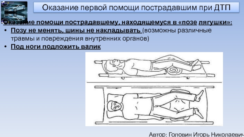 Травмы шеи при дтп: Ортопед рассказал, как не травмировать шею при ДТП — Российская газета