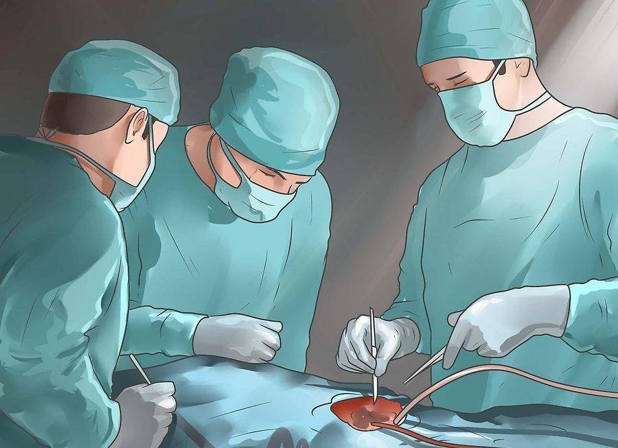 Как делают операцию аппендицит: Аппендэктомия (удаление Аппендицита)