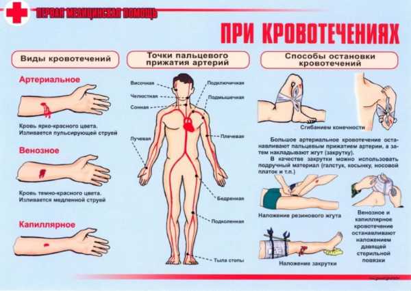 Первая доврачебная помощь при дтп – Первая помощь при ДТП